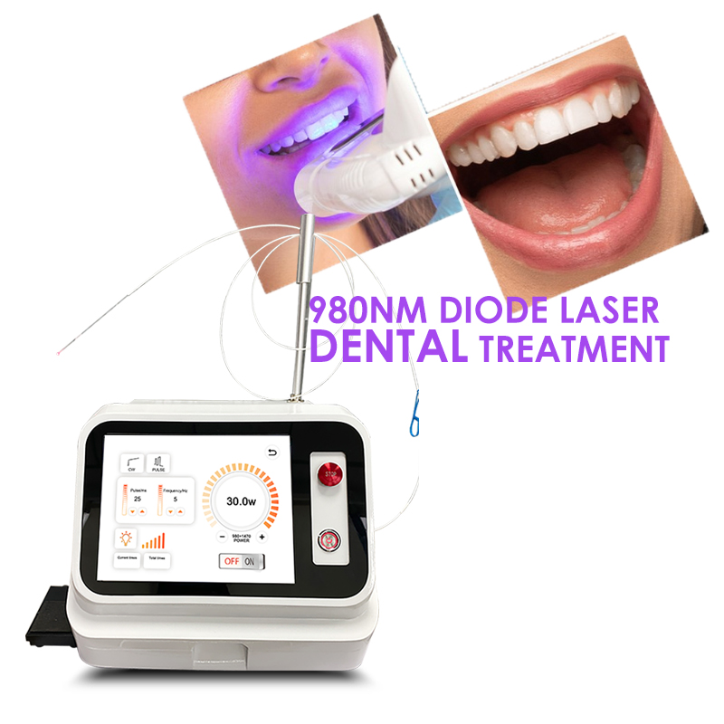 2024 Gorąca Wyprzedaż: Laser d – Teeth Whitening With Laser recenzja i cena
