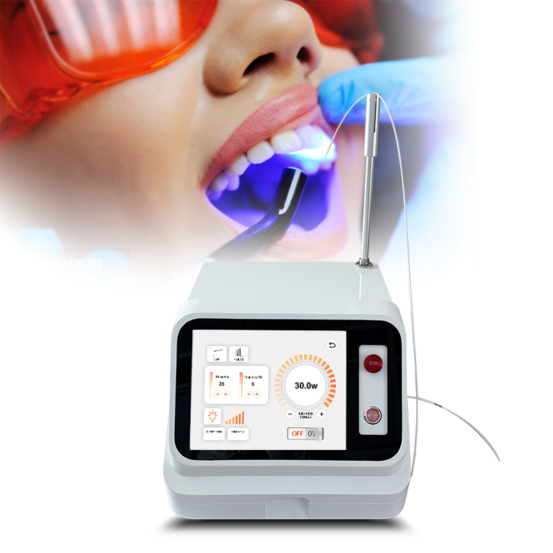 2024 Gorąca Wyprzedaż: Laser d – Teeth Whitening With Laser recenzja i cena