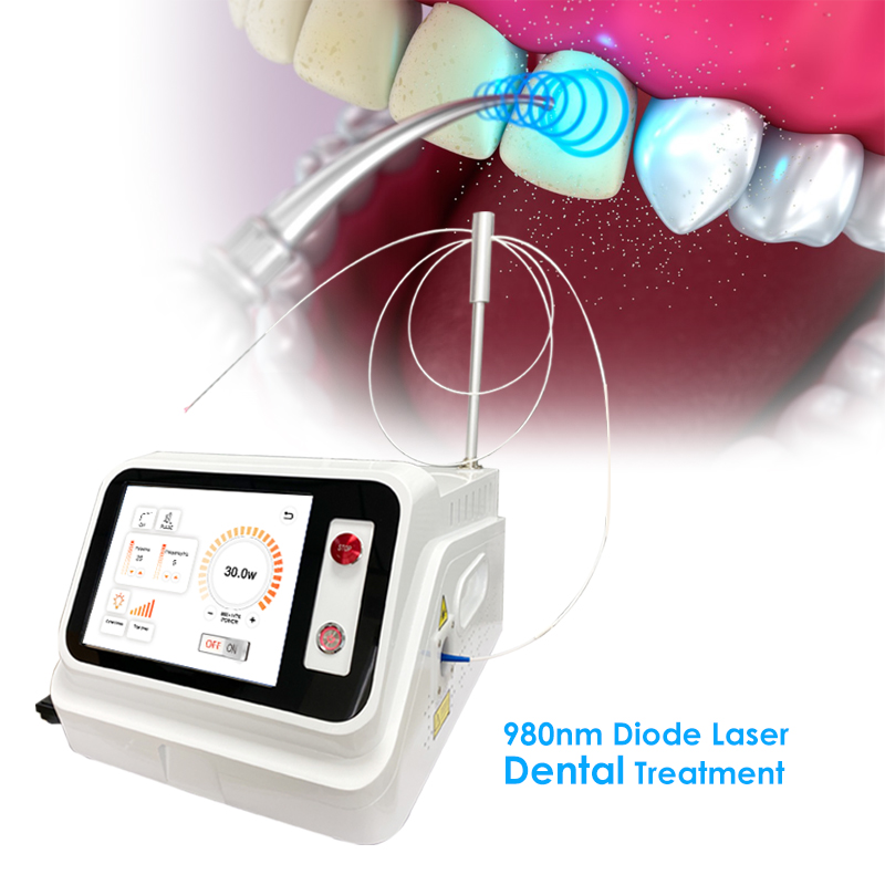 2024 Gorąca Wyprzedaż: Laser d – Teeth Whitening With Laser recenzja i cena