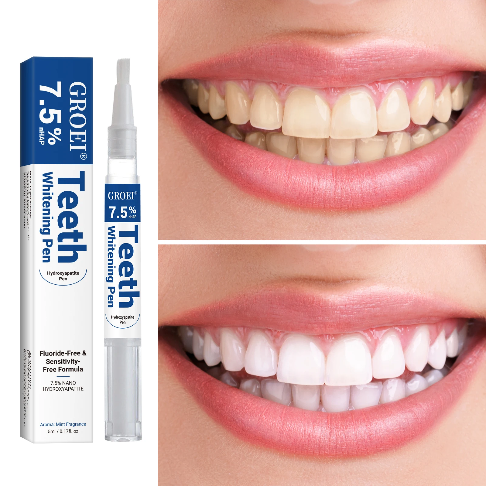 Hydroksiapatytowy długopis do  – Teeth Whitening Gels recenzja i cena