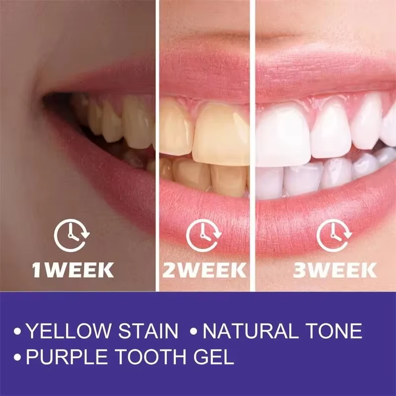 Pasta do czyszczenia i wybiela – Teeth Whitening In Korea recenzja i cena
