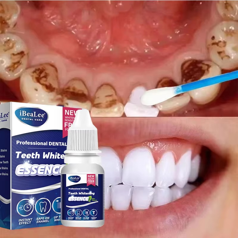 Esencja do wybielania zębów, u – Teeth Whitening Serum recenzja i cena