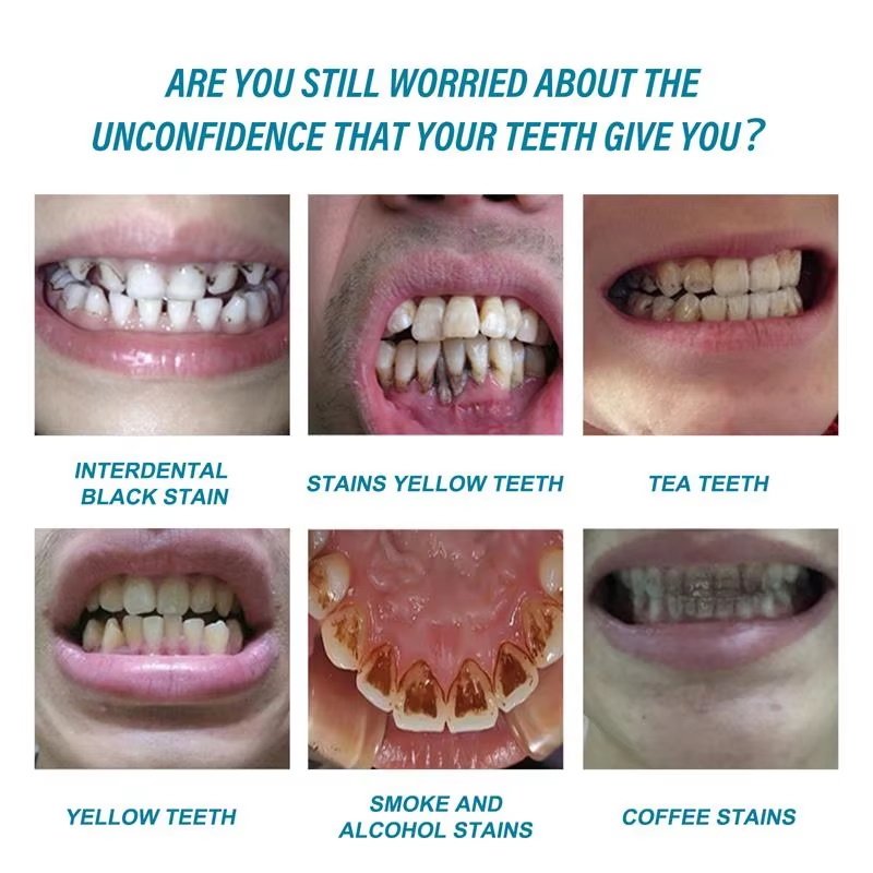 Esencja do wybielania zębów, u – Teeth Whitening Serum recenzja i cena