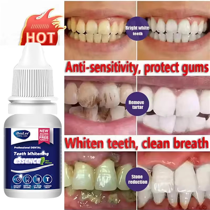 Esencja do wybielania zębów, u – Teeth Whitening Serum recenzja i cena