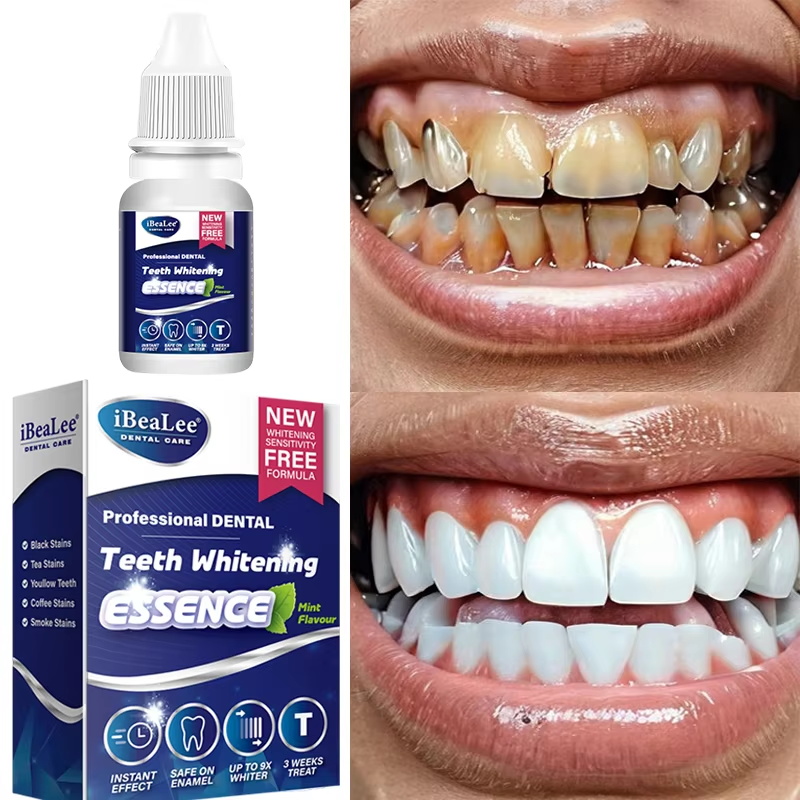 Esencja do wybielania zębów, u – Teeth Whitening Serum recenzja i cena