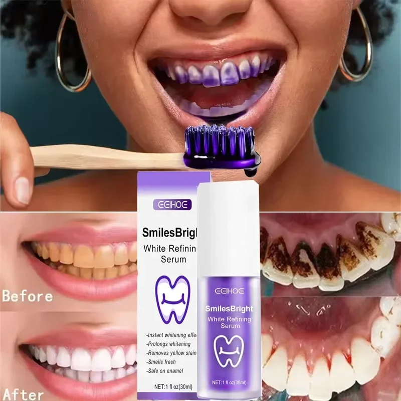 Pasta do czyszczenia i wybiela – Teeth Whitening In Korea recenzja i cena
