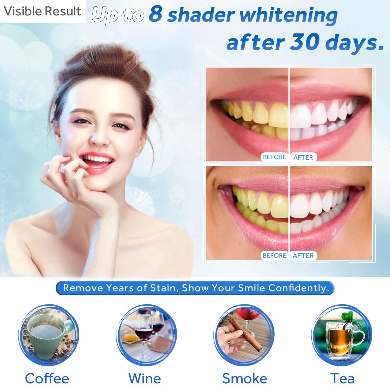 Żel do wybielania zębów w strz – Teeth Whitening Gels recenzja i cena