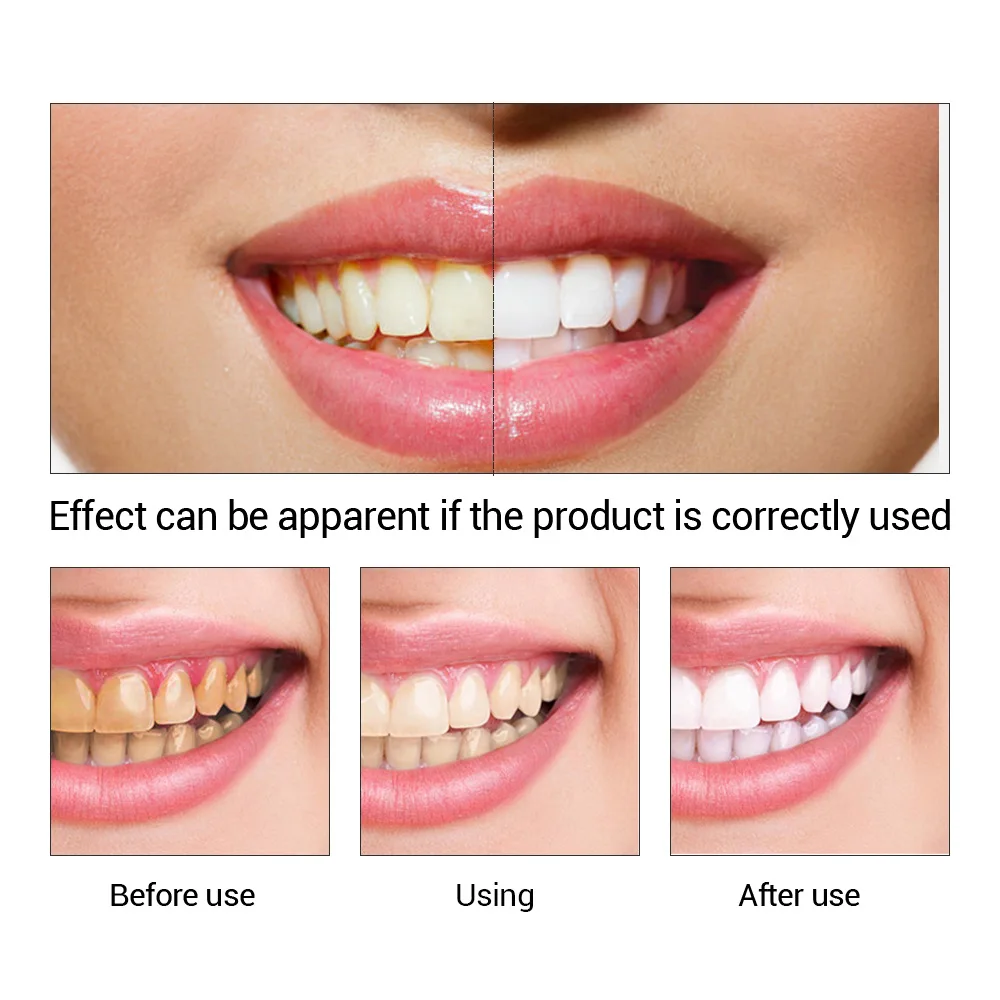 FTEENPLY esencja do wybielania – Teeth Whitening Serum recenzja i cena