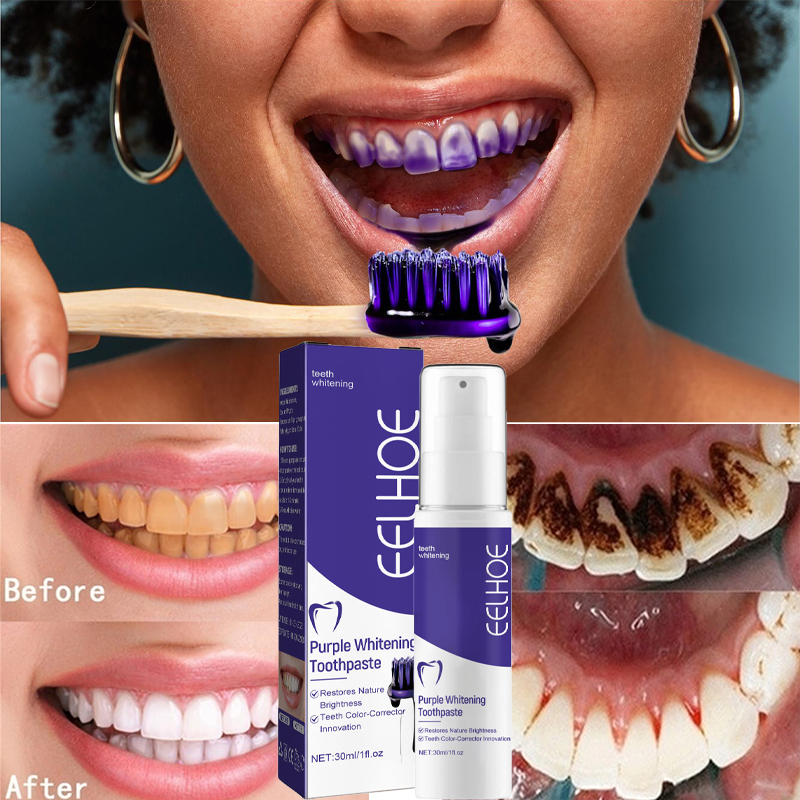 1 szt. Wybielająca wybielająca – Teeth Whitening In Korea recenzja i cena