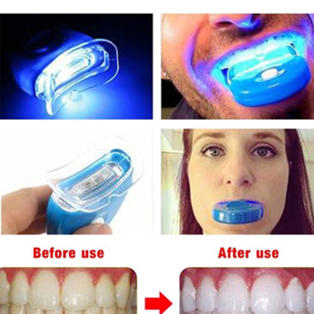 Nowy niebieski Led wybielanie  – Teeth Whitening With Laser recenzja i cena