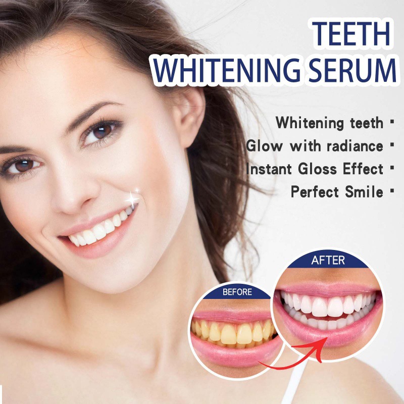 Profesjonalne serum do wybiela – Teeth Whitening Serum recenzja i cena